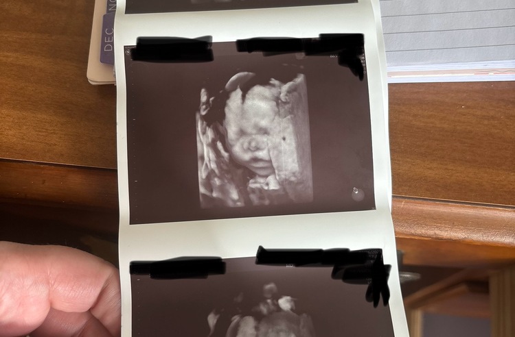 Nickolas and Emma Mackie adoption photo 2